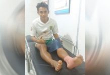 Thaufan Hidayat Dislokasi Engkel Kiri